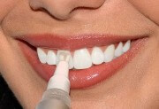 карандаш для отбеливания зубов отзывы